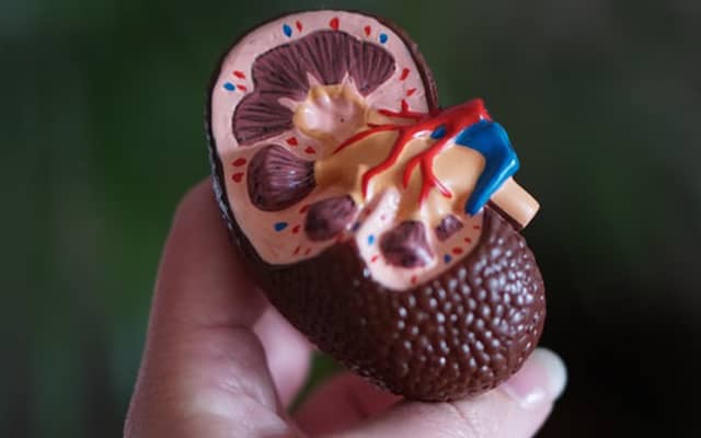Dieta při onemocnění ledvin – na co si dát pozor
